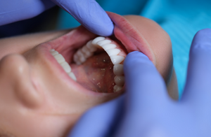 Understanding Oral Cancer: A Comprehensive Guide